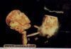 اسم الصورة=PopeShenoudaIII_(73).jpg
حجم الملف=7كيلوبايت
الأبعاد=350x247
تاريخ الإضافة=%594 %07, %2008 PopeShenoudaIII_(73).jpg